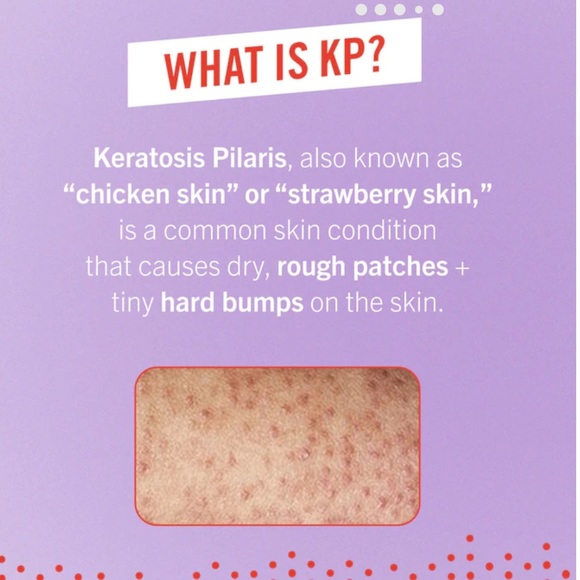 First Aid Beauty KP bump eraser, 1.0 oz. - Picture 7 of 9